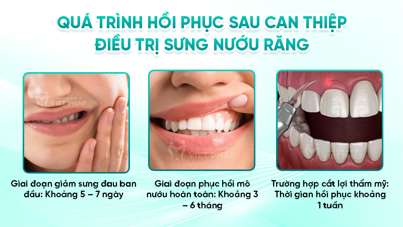 sung nuou rang 7 Quá trình hồi phục sau can thiệp điều trị sưng nướu răng