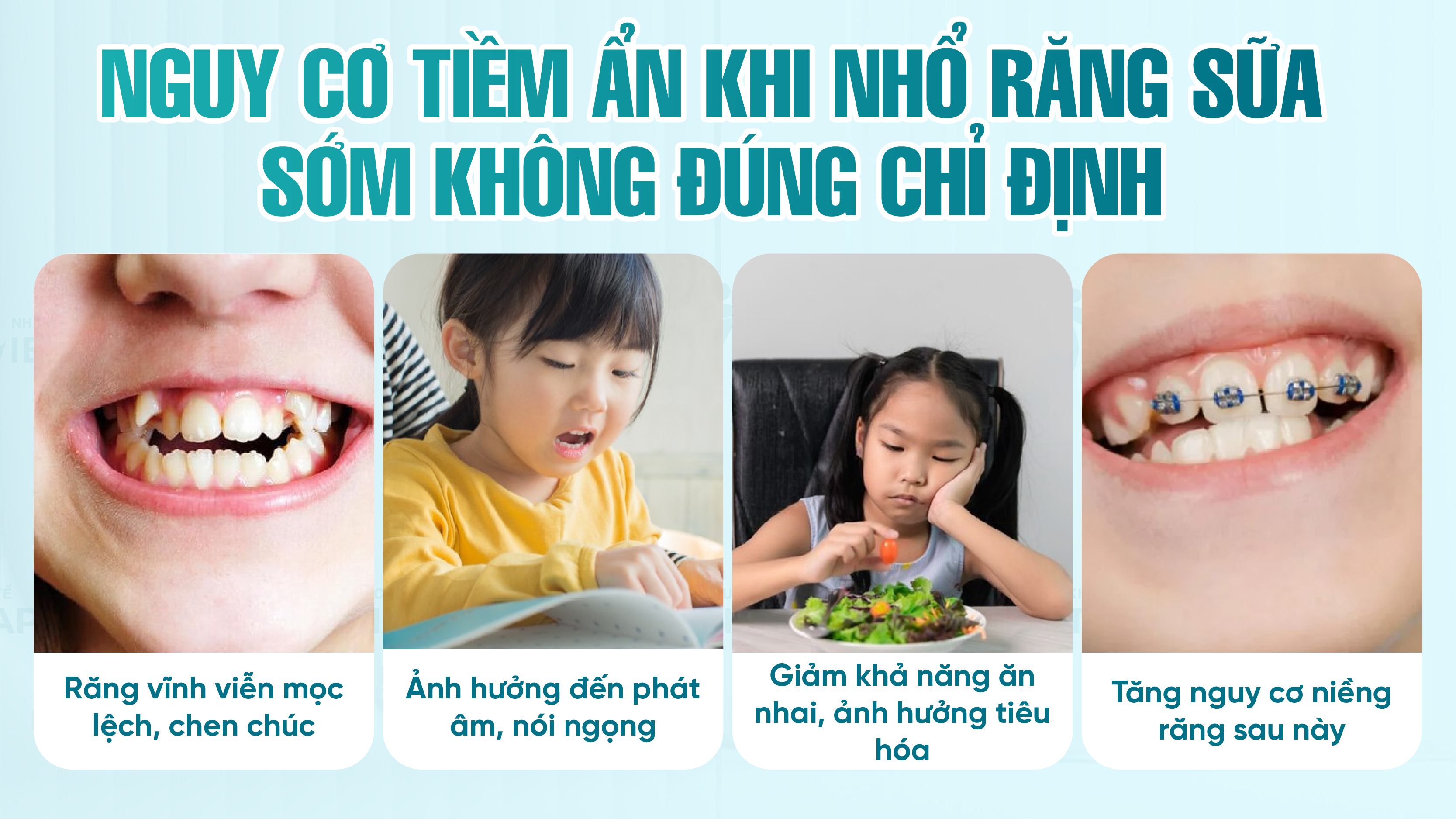 Nguy cơ tiềm ẩn khi nhổ răng sữa sớm không đúng chỉ định