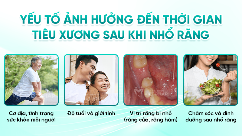 nho rang bao lau thi tieu xuong 2 Yếu tố ảnh hưởng đến thời gian tiêu xương sau khi nhổ răng