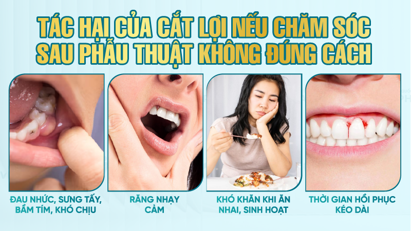 tac hai cua cat loi 6 Tác hại của cắt lợi nếu chăm sóc sau phẫu thuật không đúng cách