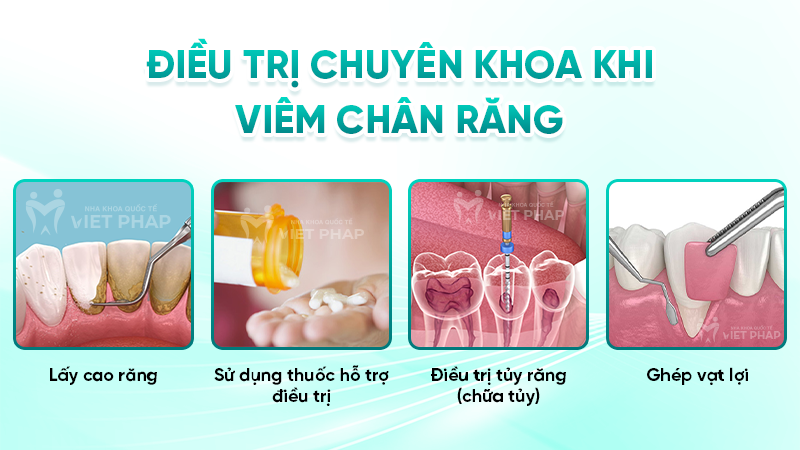 Điều trị chuyên khoa khi viêm chân răng 