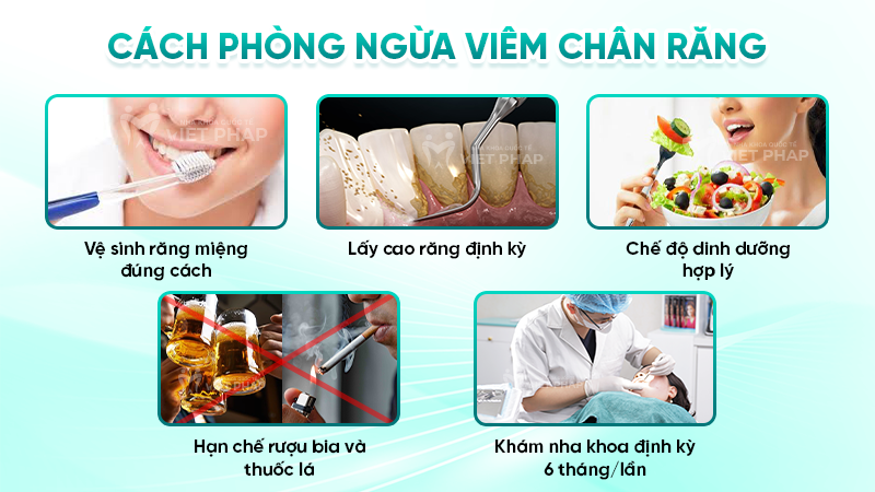 Cách phòng ngừa viêm chân răng