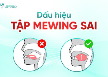 [Sai lầm] 7 Dấu hiệu tập mewing sai - 6 hậu quả khôn lường