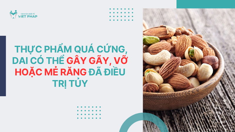 rang chet tuy ton tai duoc bao lau 5 Thực phẩm quá cứng, dai có thể gây gãy, vỡ hoặc mẻ răng đã điều trị tủy