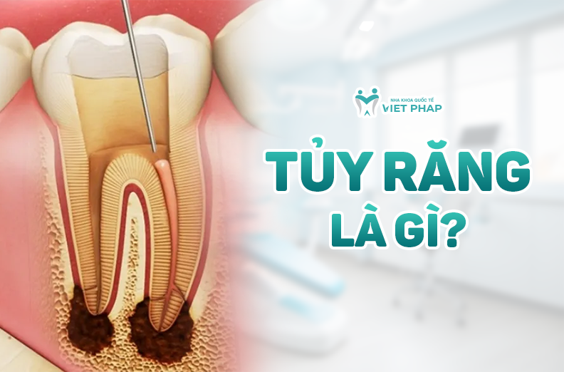 Tủy răng là gì? Cấu tạo, chức năng và các bệnh lý thường gặp