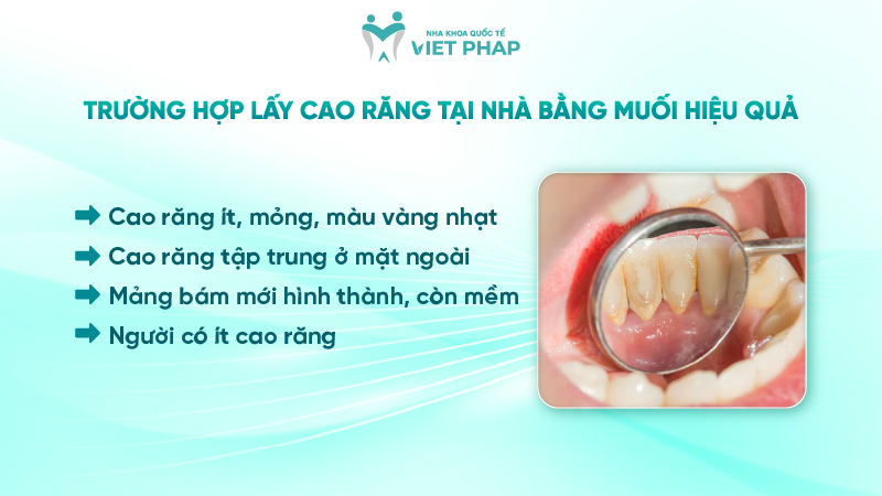 cach lay cao rang tai nha bang muoi 5 Trường hợp lấy cao răng tại nhà bằng muối hiệu quả