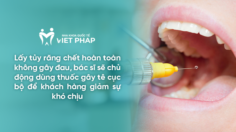 lay tuy rang chet co dau khong 1 Lấy tủy răng chết hoàn toàn không gây đau, bác sĩ sẽ chủ động dùng thuốc gây tê cục bộ để khách hàng giảm sự khó chịu