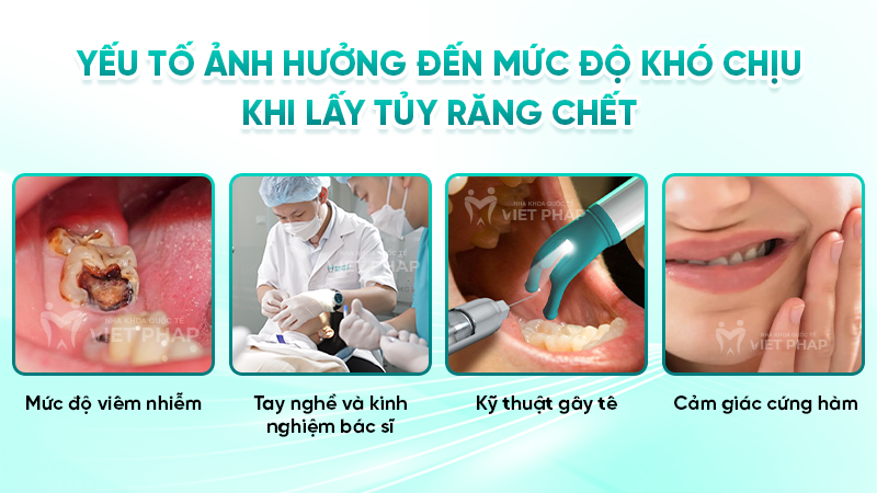 lay tuy rang chet co dau khong 3 Yếu tố ảnh hưởng đến mức độ khó chịu khi lấy tủy răng chết