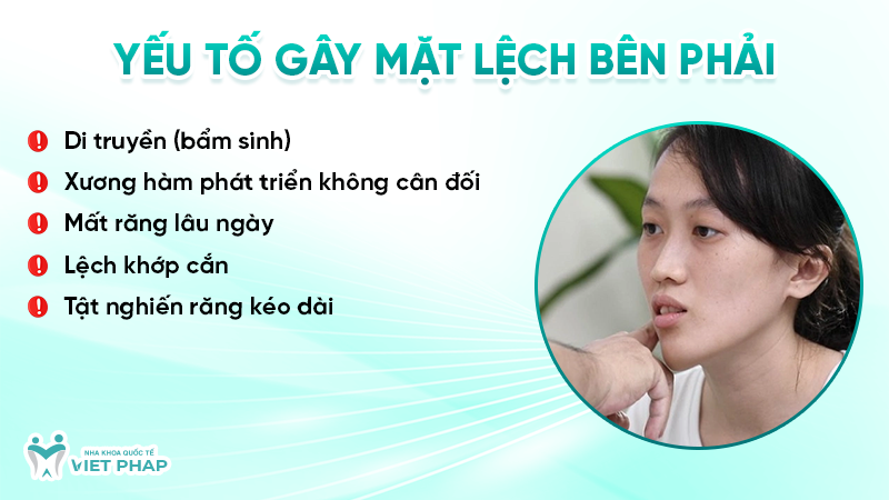 mat lech ben phai 2.2 Yếu tố gây mặt lệch bên phải