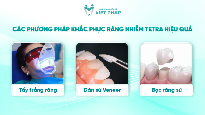 Các phương pháp khắc phục răng nhiễm Tetra hiệu quả