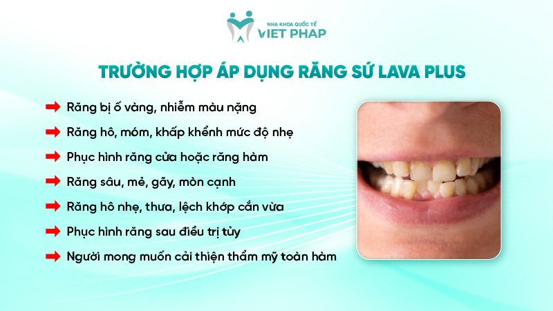 rang su lava plus 03 Trường hợp áp dụng răng sứ Lava Plus