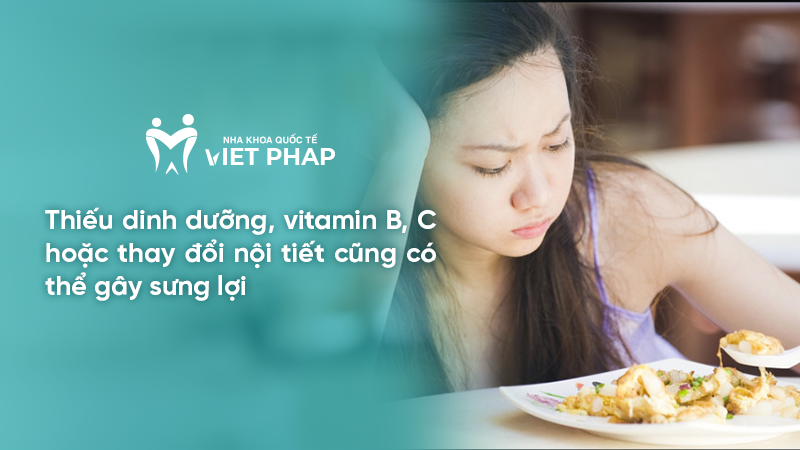 Thiếu dinh dưỡng, vitamin B, C hoặc thay đổi nội tiết cũng có thể gây sưng lợi