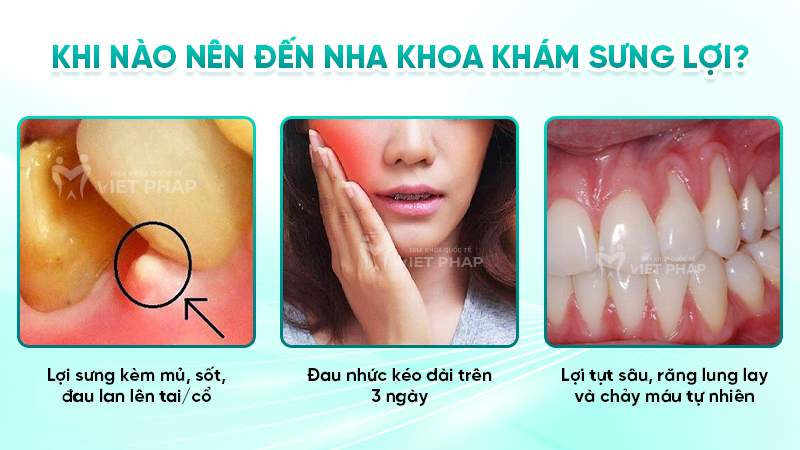 Khi nào nên đến nha khoa khám sưng lợi?