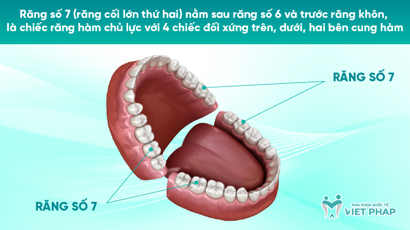 251203 rang so 7 o vi tri nao 02 Răng số 7 (răng cối lớn thứ hai) nằm sau răng số 6 và trước răng khôn, là chiếc răng hàm chủ lực với 4 chiếc đối xứng trên, dưới, hai bên cung hàm