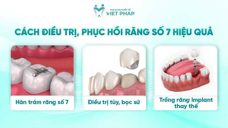 251203 rang so 7 o vi tri nao 05 Cách điều trị, phục hồi răng số 7 hiệu quả