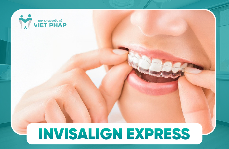 Ưu điểm niềng răng Invisalign Express - Số lượng khay, tính năng, chi phí