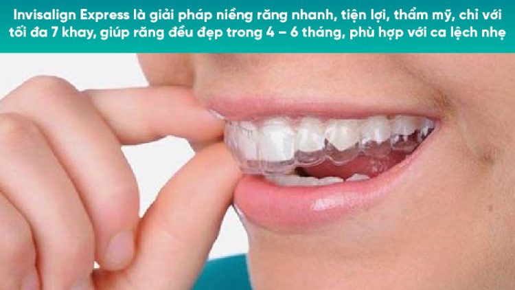 Ưu điểm niềng răng Invisalign Express - Số lượng khay, tính năng, chi phí