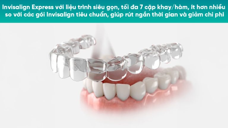 Ưu điểm niềng răng Invisalign Express - Số lượng khay, tính năng, chi phí