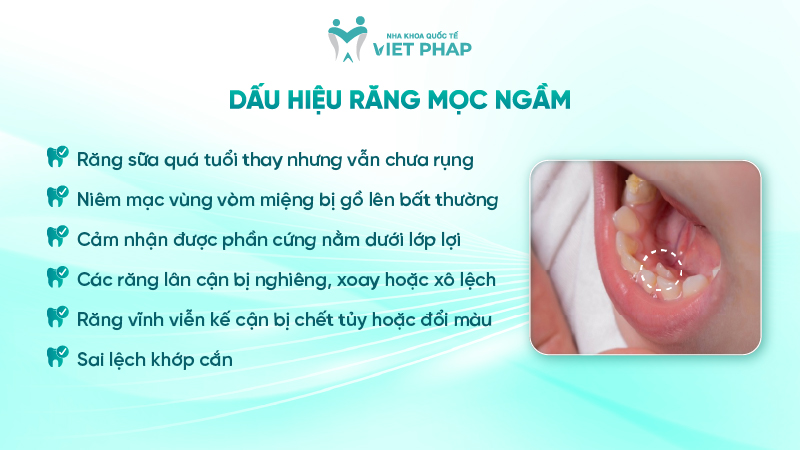 rang moc ngam 2 Dấu hiệu răng mọc ngầm