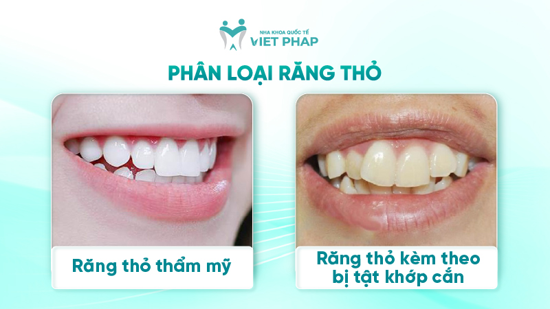 rang tho 3 Phân loại răng thỏ