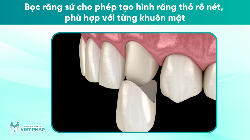 rang tho 6 Bọc răng sứ cho phép tạo hình răng thỏ rõ nét, phù hợp với từng khuôn mặt
