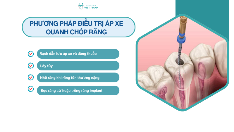 ap xe quanh chop rang 5 Phương pháp điều trị áp xe quanh chóp răng