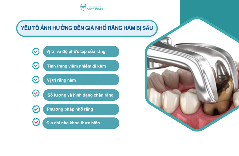 Yếu tố ảnh hưởng đến giá nhổ răng hàm bị sâu