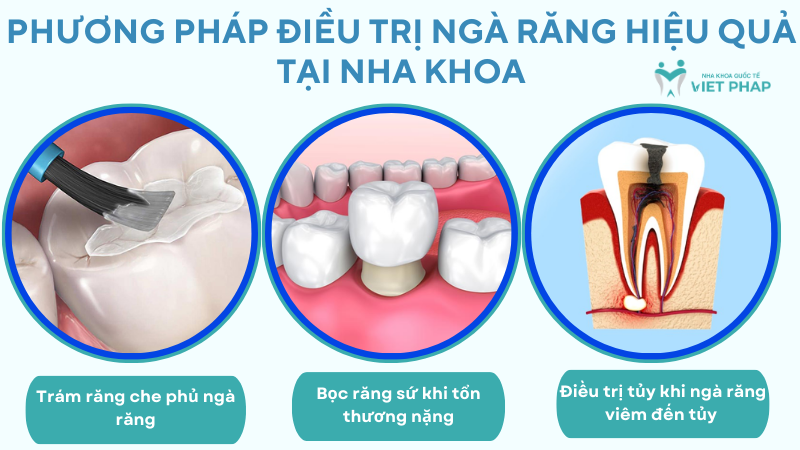 Phương pháp điều trị ngà răng hiệu quả tại nha khoa