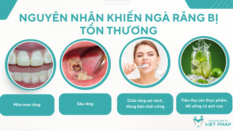 Nguyên nhân khiến ngà răng bị tổn thương