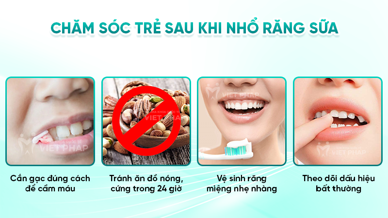 Chăm sóc trẻ sau khi nhổ răng sữa