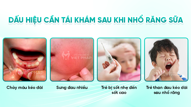 Dấu hiệu cần tái khám sau khi nhổ răng sữa