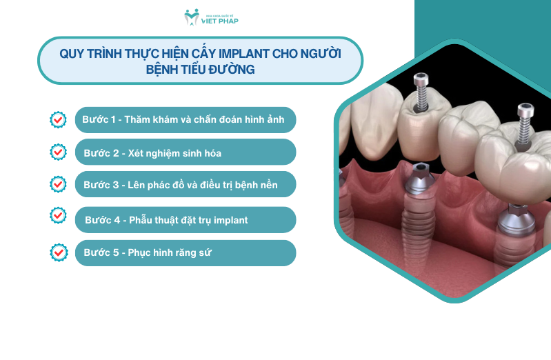 Quy trình thực hiện cấy implant cho người bệnh tiểu đường