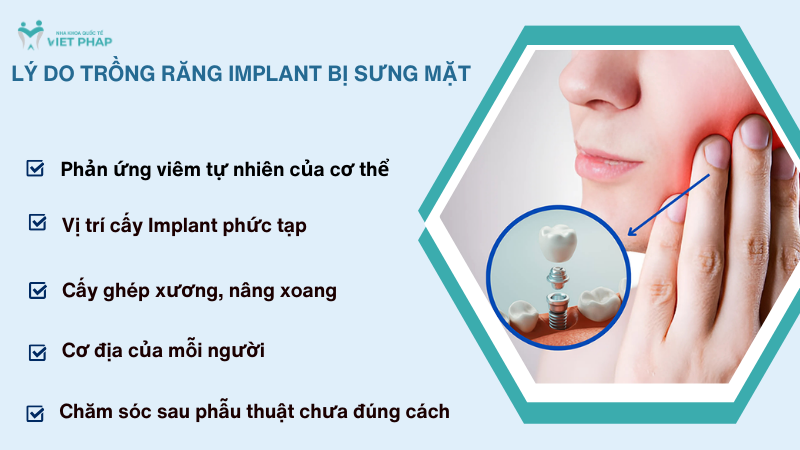 Lý do trồng răng Implant bị sưng mặt