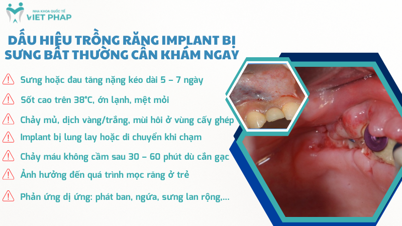 Dấu hiệu trồng răng Implant bị sưng bất thường cần khám NGAY