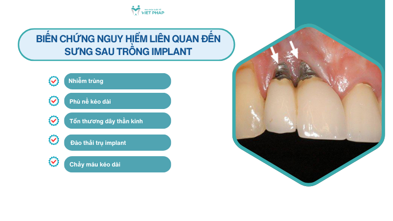 Biến chứng nguy hiểm liên quan đến sưng sau trồng implant
