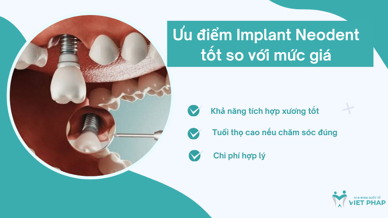 Implant neodent gia bao nhieu nha khoa quoc teviet phap 4 Ưu điểm Implant Neodent tốt so với mức giá