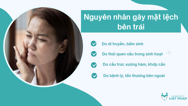mat lech ben trai 3 Nguyên nhân gây mặt lệch bên trái