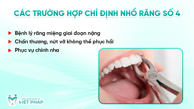 rang so 4 6 Các trường hợp chỉ định nhổ răng số 4