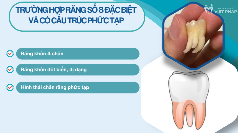 Trường hợp răng số 8 đặc biệt và có cấu trúc phức tạp