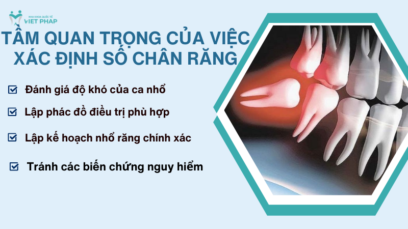 Tầm quan trọng của việc xác định số chân răng 