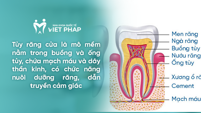 tuy rang cua 1 Tủy răng cửa là mô mềm nằm trong buồng và ống tủy, chứa mạch máu và dây thần kinh, có chức năng nuôi dưỡng răng, dẫn truyền cảm giác