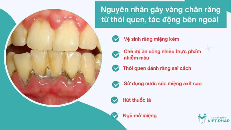 Nguyên nhân gây vàng chân răng từ thói quen, tác động bên ngoài