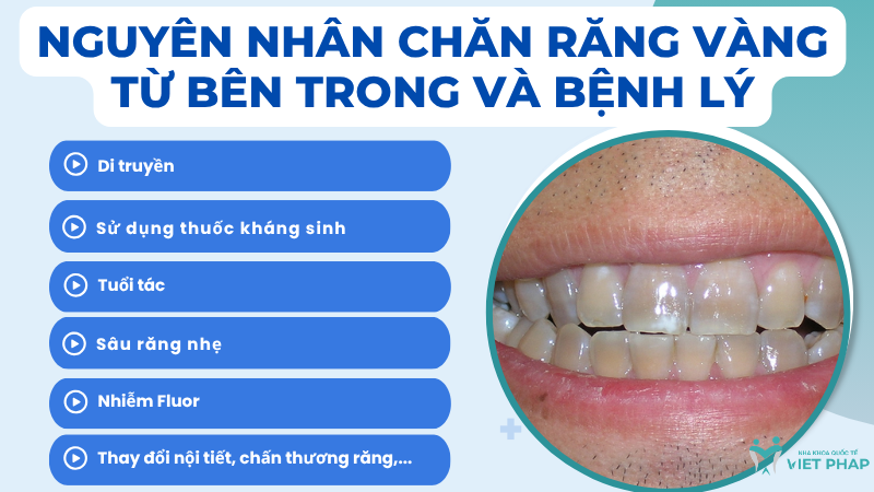 Nguyên nhân chăn răng vàng từ bên trong và bệnh lý