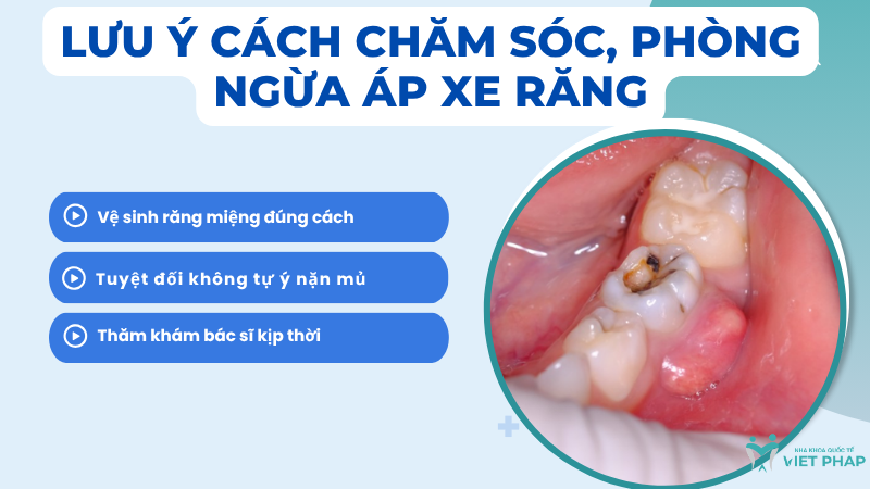 ap xe rang kieng an gi 4 Lưu ý cách chăm sóc, phòng ngừa áp xe răng
