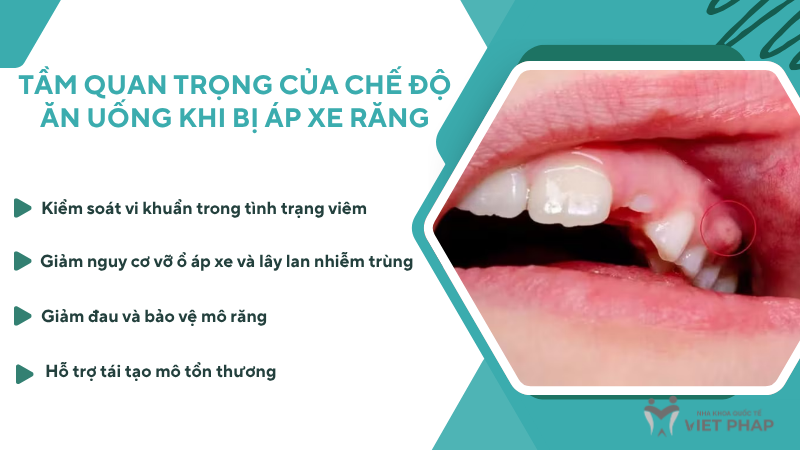 ap xe rang kieng an gi Tầm quan trọng của chế độ ăn uống khi bị áp xe răng