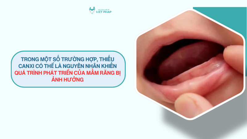be 8 thang chua moc rang co phai thieu canxi 2 Trong một số trường hợp, thiếu canxi có thể là nguyên nhân khiến quá trình phát triển của mầm răng bị ảnh hưởng