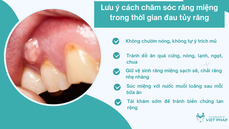 Lưu ý cách chăm sóc răng miệng trong thời gian đau tủy răng