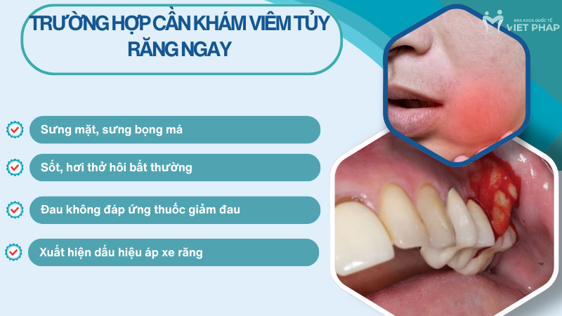 Trường hợp cần khám viêm tủy răng NGAY