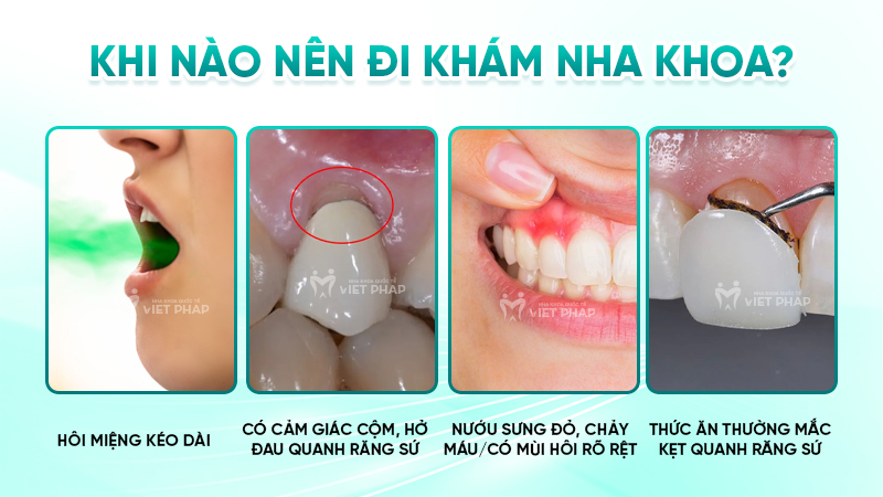 cach tri hoi mieng khi boc rang su 4 Khi nào nên đi khám nha khoa?