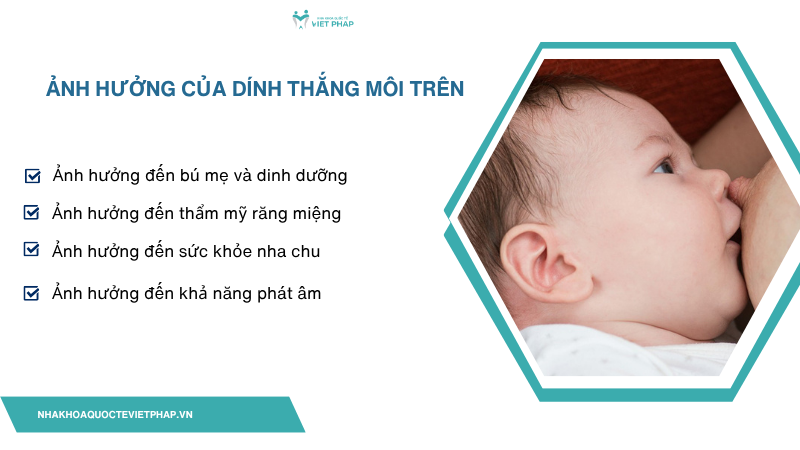 Ảnh hưởng của dính thắng môi trên